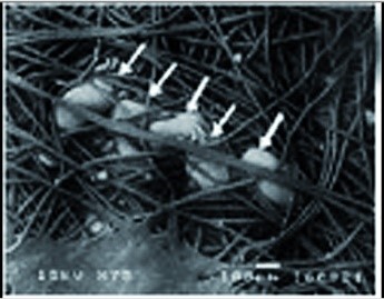 Eingeklemmte Milbeneier